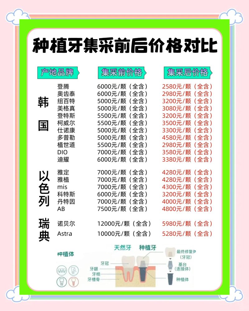 种植牙价格：了解行业的最新动态
